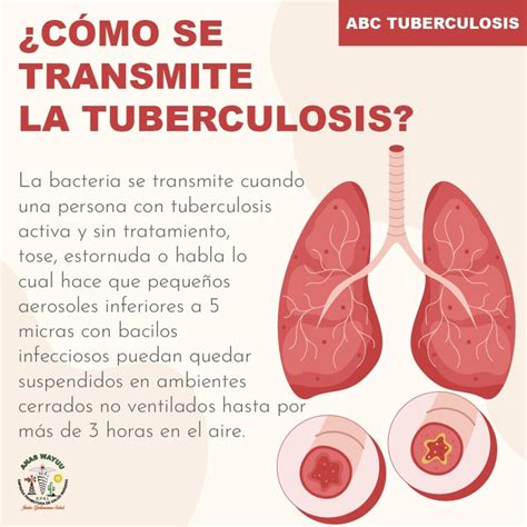 La Tuberculosis Puede Ser Mortal Si No Se Trata Adecuadamente Anas