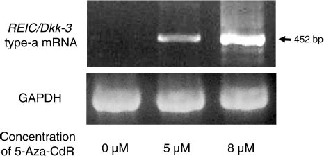 Restoration Of Reic Dkk Type A Mrna Expression In Mda Mb Cells