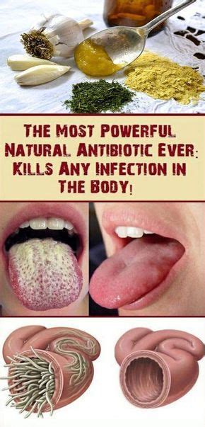 The Most Powerful Natural Antibiotics That You Can Make At Home Homemade Antibiotic Natural