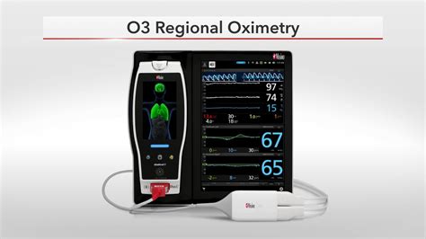 The Benefits Of Masimos O3® Regional Oximetry Youtube