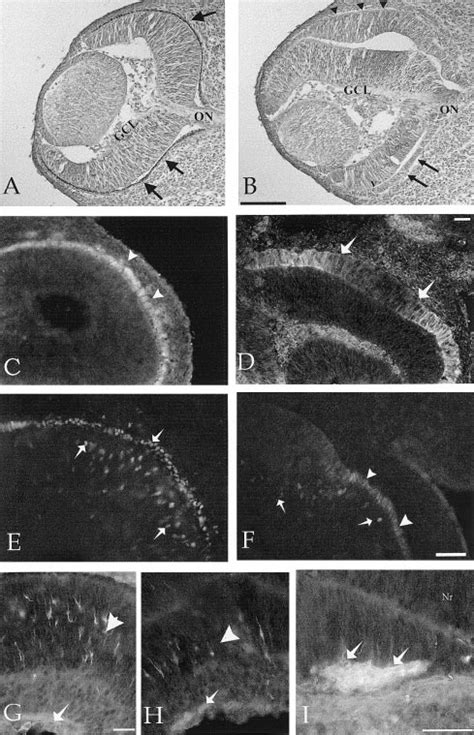 E13 14 Wild Type And Mi Mi Neural Retina Stained With Cresyl Violet And