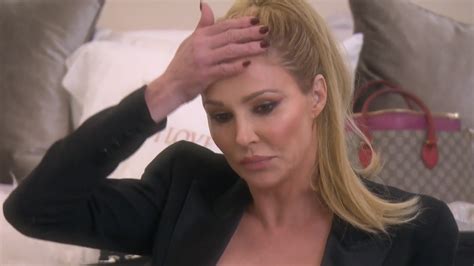 Brandi Glanville Reveals Disfigured Face I Blame Bravo