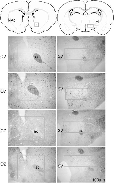 Representative Photomicrographs Showing C Fos Immunoreactivity In The