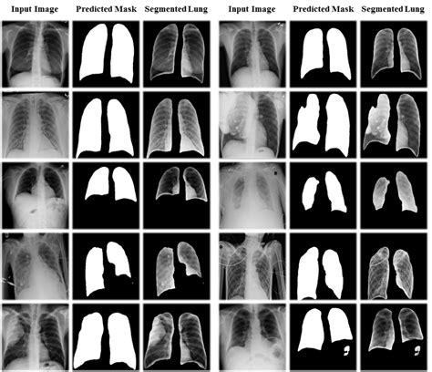 Lung Segmentation