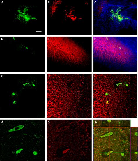 Multipotent Adult Progenitor Cell Mapc Graft Survival In Hi Brains Of