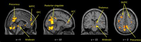 Frontiers Genetic Imaging Of The Association Of Oxytocin Receptor