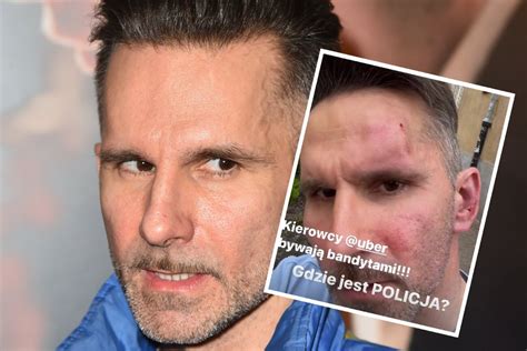 Marcin Bosak został dotkliwie pobity na ulicy Gdzie jest policja