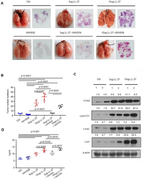 The β Catenin Pathway Plays A Critical Role In The Stimulation Of Lung Download Scientific