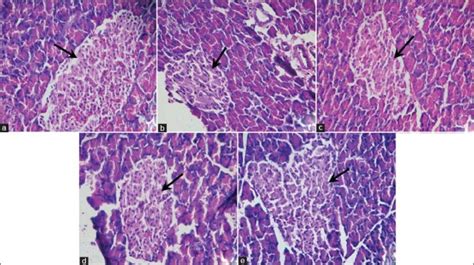 Histopathology Of Pancreas Of Diabetic Rats Treated With Cocos Nucifera