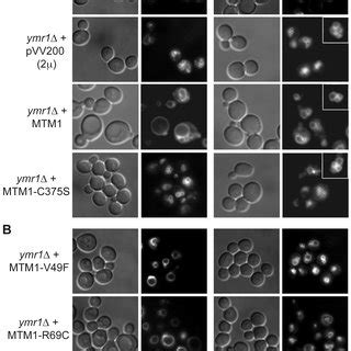 Vacuolar Morphologies Quantification In Yeast Cells Producing MTM1 The