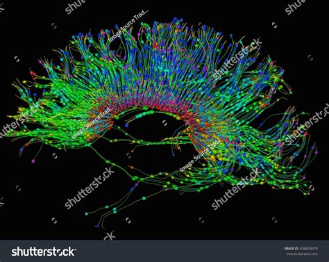 Diffusion Mri Referred Diffusion Tensor Imaging Stock Illustration