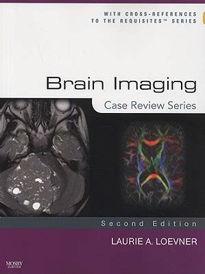 Brain Imaging Case Review Series Laurie A Loevner