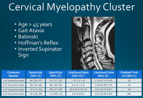 Cervical Myelopathy vs. Radiculopathy