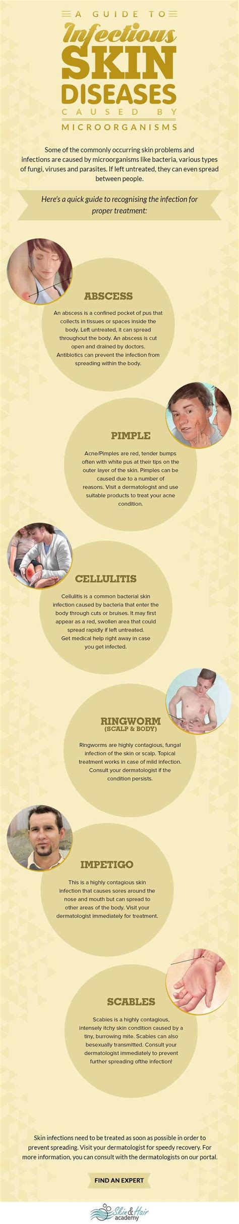 A Guide to Recognize Common Skin Infections | Skin diseases, Skin ...