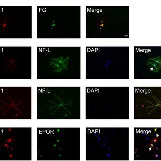 Identification And Morphology Of Adult Rat RGCs In A Mixed Culture A