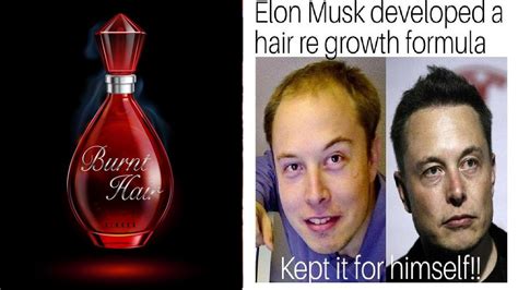 Top 48 Image Elon Musk Burnt Hair Thptnganamst Edu Vn