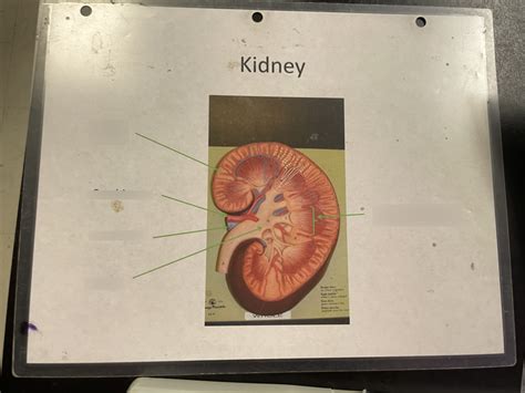 Kidney Diagram | Quizlet