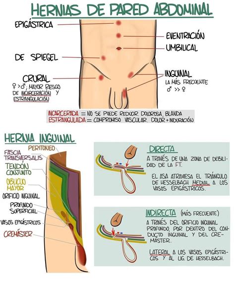 Pin de AprilOk en ANATOMÍA Diagnosticos de enfermeria Cosas de