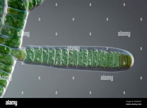 Stigonema Mammilosum Cyanobacteria Light Micrograph Stock Photo Alamy