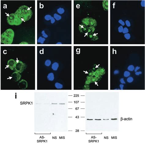 Effect Of Antisense Odn Treatment On Srpk1 Protein Expression And