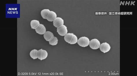 劇症型溶血性レンサ球菌感染症 去年1年間の患者数 過去最多 Nhk 医療・健康