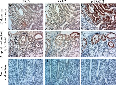 Representative Immunohistochemical Staining Showed BKCa ERK1 2 And