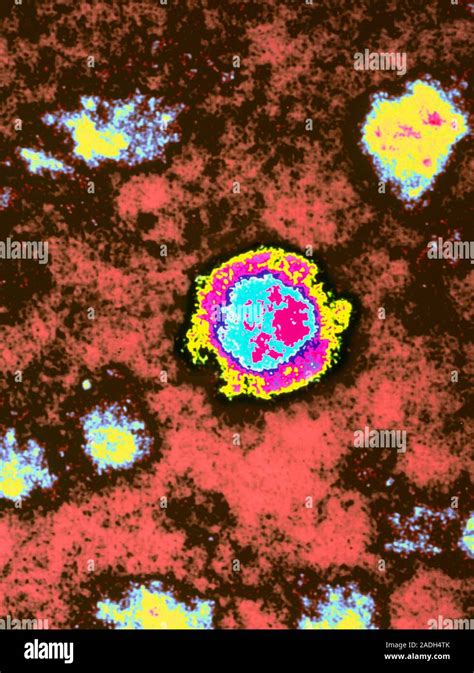 Borna virus. Coloured Transmission Electron Micro- graph of a Borna ...