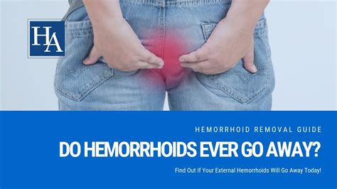 Do External Hemorrhoids Ever Go Away Find Out If Your External Hemorrhoids Will Go Away Today