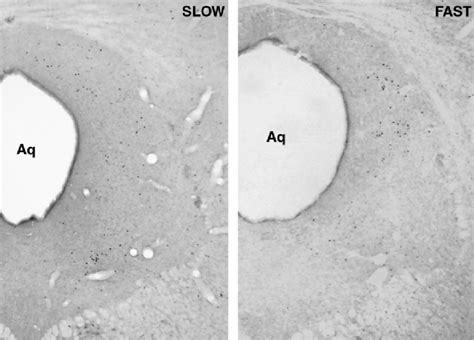 Photomicrographs Of The Distributions Of Fos Positive Neurons In The