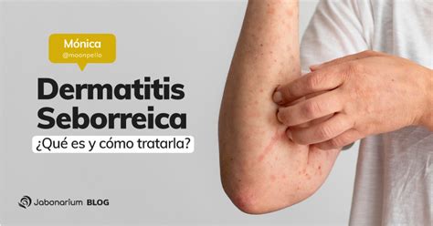 Imperialismo Estado Coca Na Jabon Para La Dermatitis Seborreica En La