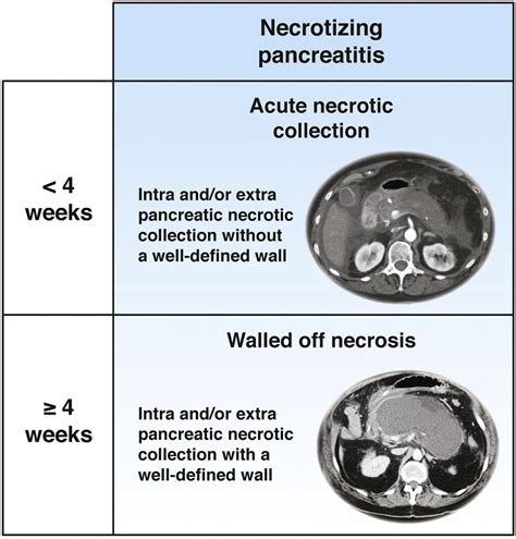 Management Of Infected Pancreatic Necrosis In The Intensive Care Unit A Narrative Review