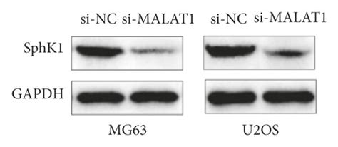 Identifying The Regulatory Relationship Between Malat1 Mir 124 3p And