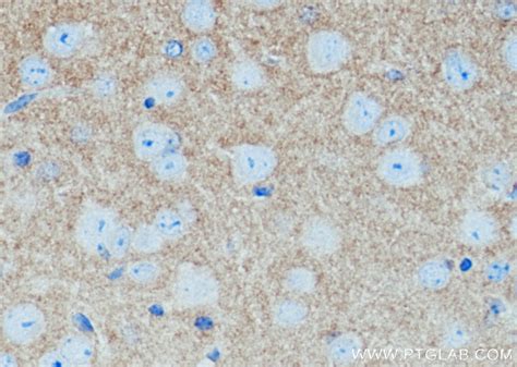 N cadherin antibody 22018 1 AP Proteintech 武汉三鹰生物技术有限公司