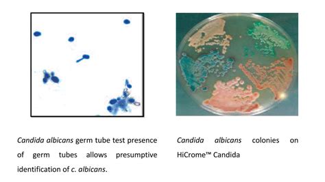 Practical Medical Mycology Lab 8 Yeast Identification Ppt Download