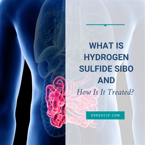 What Is Hydrogen Sulfide Sibo And How Is It Treated