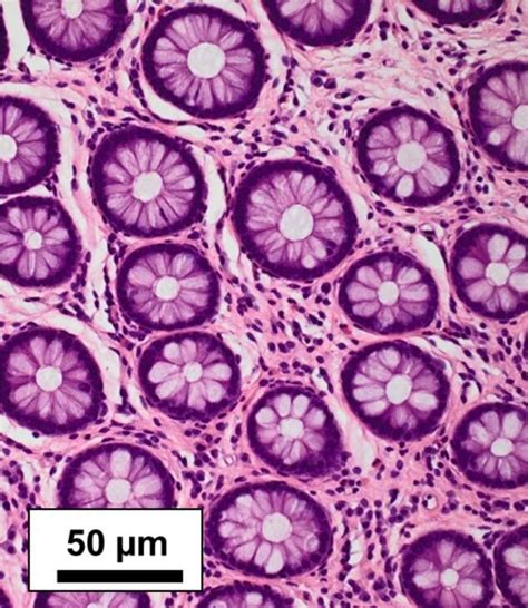 Hande Staining Of Colonic Mucosal Biopsy × 200 Magnification Download Scientific Diagram