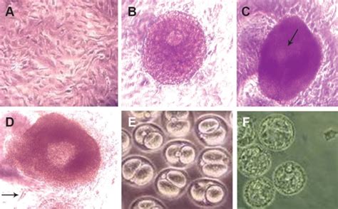 In Vitro Maturation Of Preantral Follicle From 14 Day Old Mice A Download Scientific Diagram