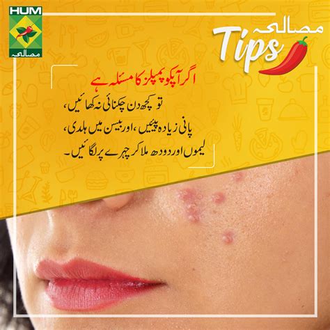 How To Get Rid Of Pimples Overnight 6 Diys That Work Artofit