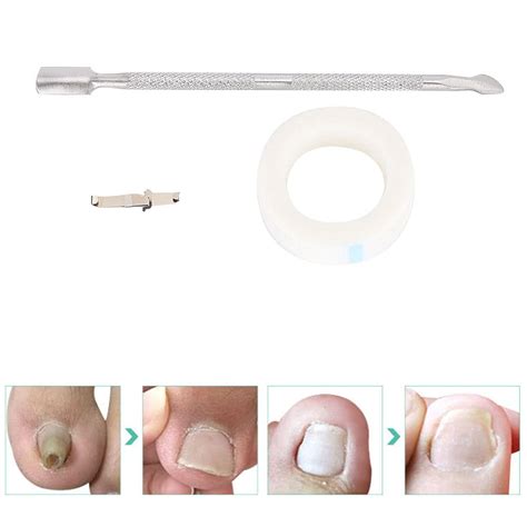 Buy Ingrown Toenail Pedicure Tool Straightening Clip Curved Brace