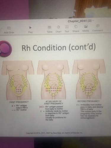 Medical Terminology Chapter 4 Flashcards Quizlet