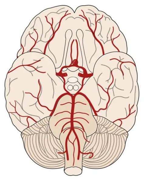 2-Minute Neuroscience: Brain Aneurysms