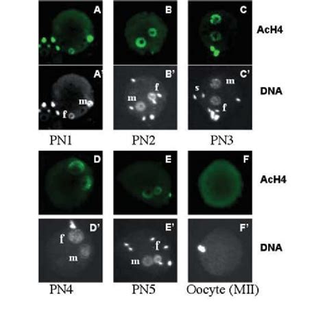 Representative Fluorescent Micrographs Of Metaphase Ii Oocytes And Download Scientific Diagram