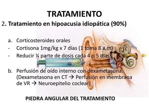 Ppt Hipoacusia SÚbita Sensorineural IdiopÁtica Powerpoint