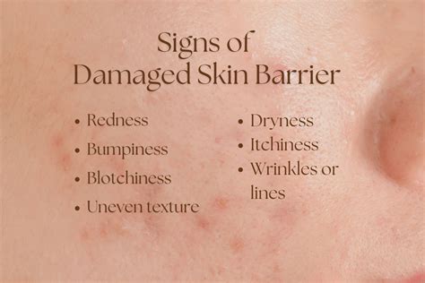 Ultimate Guide To Repairing Your Skin Barrier V Medi Aesthetics Skincare