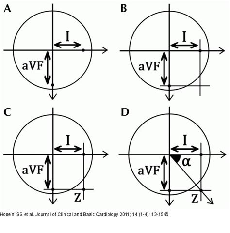 Heart Axis