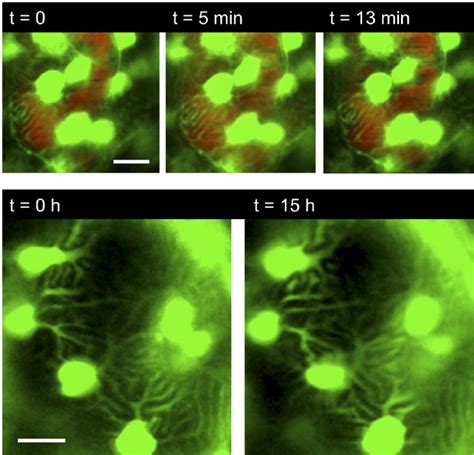 Podocyte Processes Can Be Visualized In Vivo Over Time Upper Panel Et