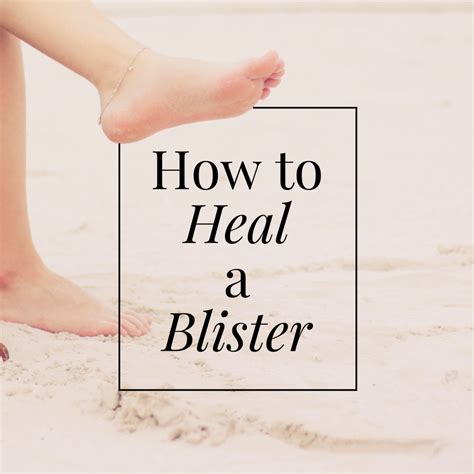 Blisters: Causes and Treatment - YouMeMindBody