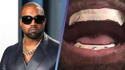 Kanye West's titanium teeth leave people wondering how he'll clean them