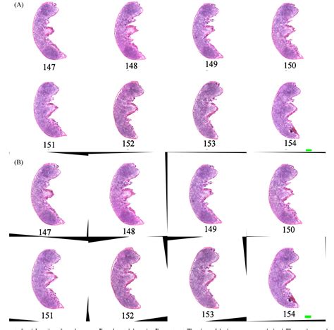 Figure 2 From Serial Sectioning And Three Dimensional Reconstruction Of