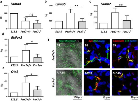 Analysis Of Basal Lamina And Nmj Functionality In Pax7 And Pax7−−